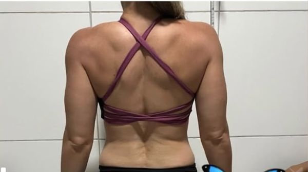 Costas após 60 dias de treino